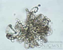 dolichospermum (image 2)