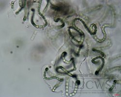 nostoc at 400x magnification photo two