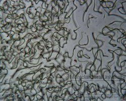 nostoc at 100x magnification