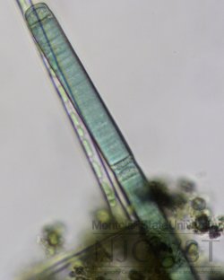 Verona Park oscillatoria at 400x magnification photo two