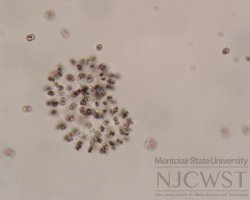 woronichinia (image 4)